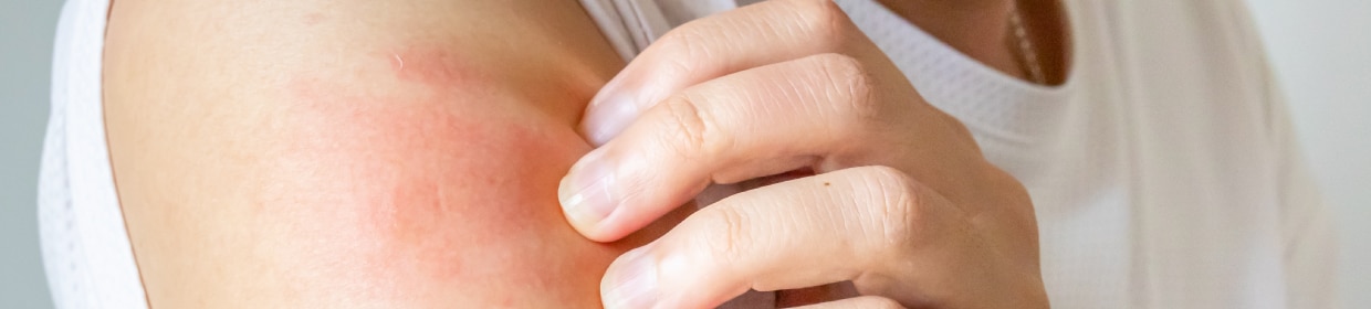 202505_buyingguide_eczema_1240x280.jpg
